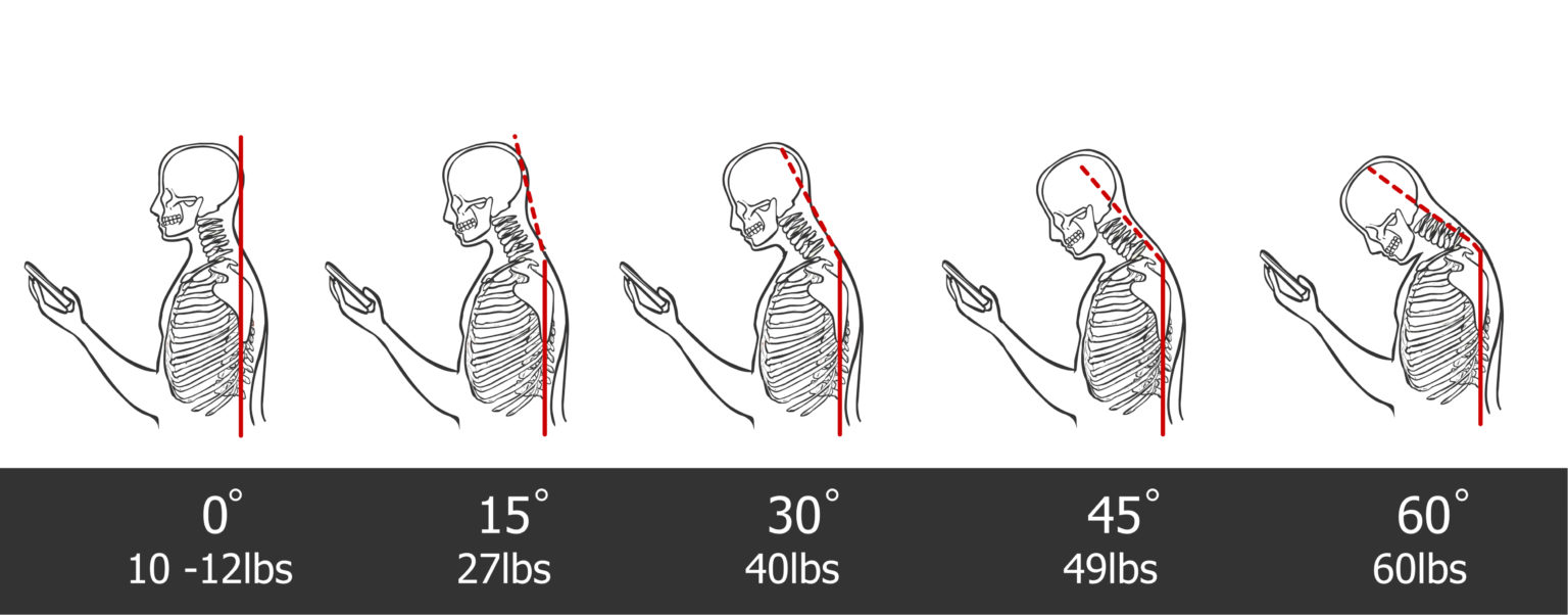 Neck-posture-1536x602