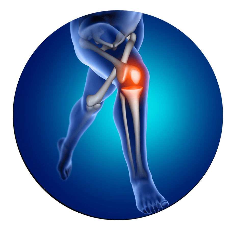 Illustration of a running leg skeleton with the knee joint highlighted in pain