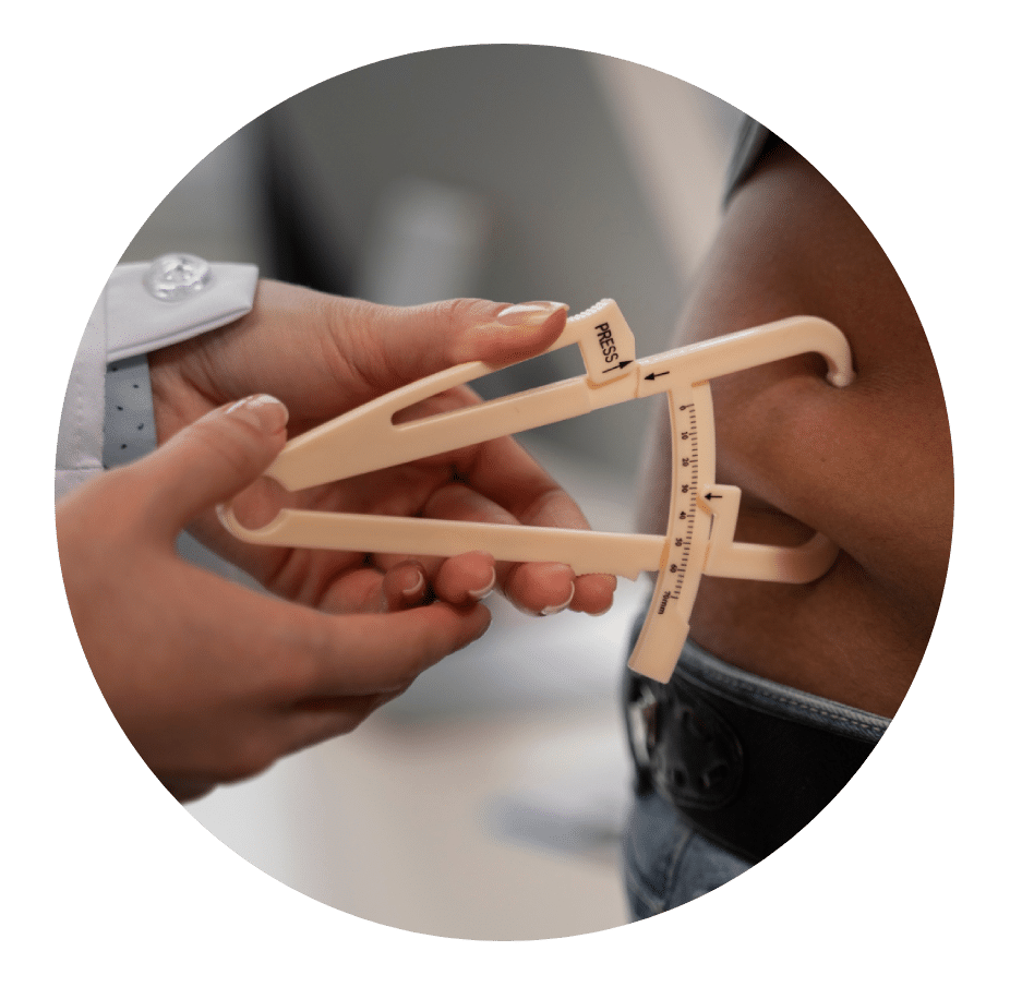 Clinician measuring a patient's waist with a skinfold caliper
