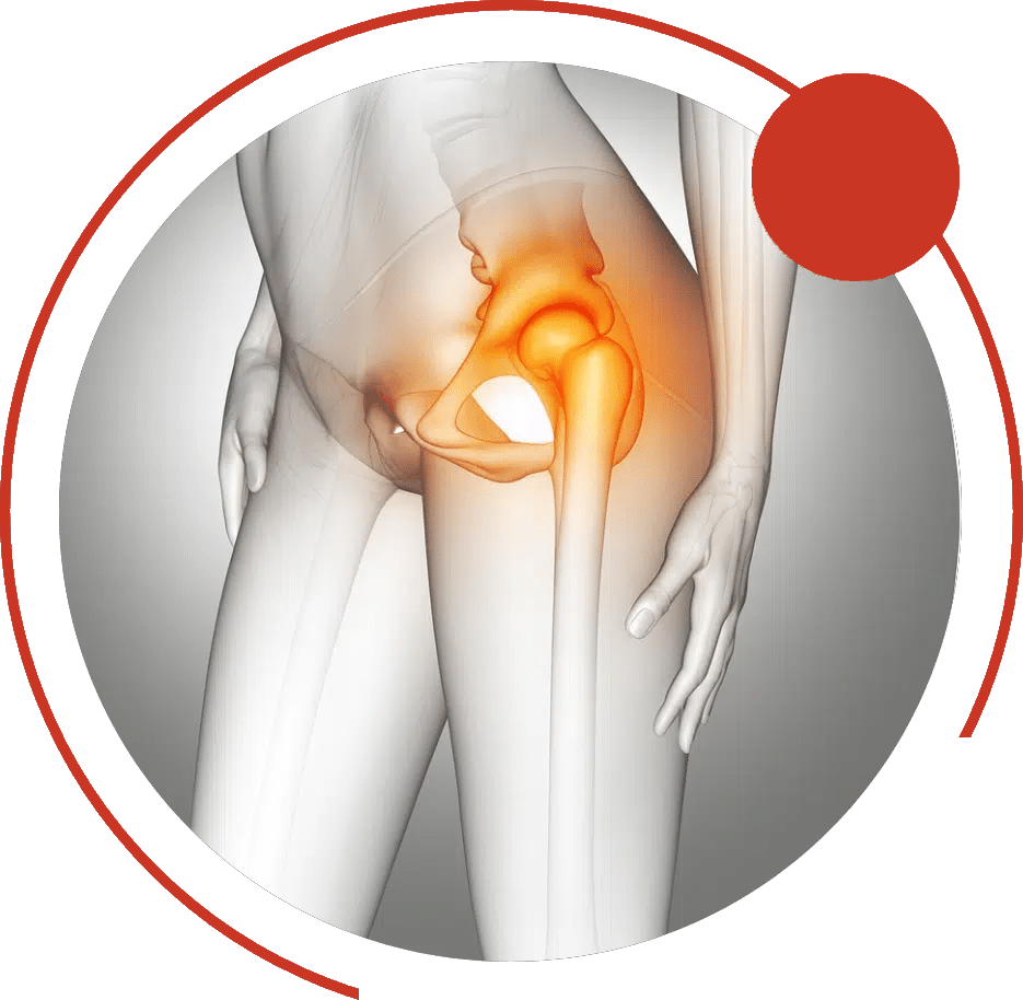 Illustration of the hip joint glowing orange to show hip pain