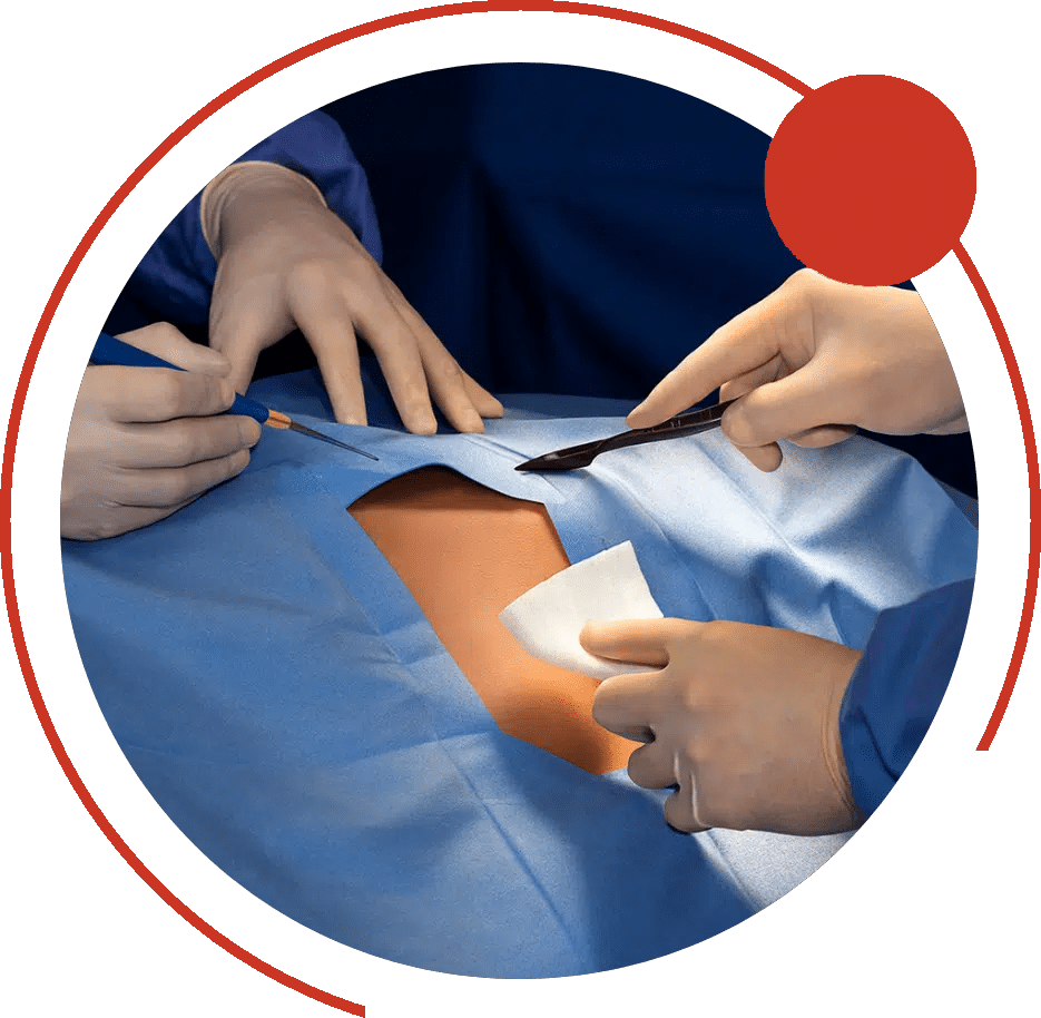 Surgeons' gloved hands with a scalpel and gauze during an operation